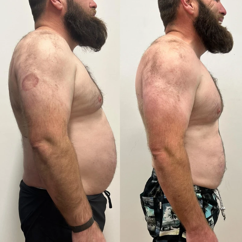Anthony transformation