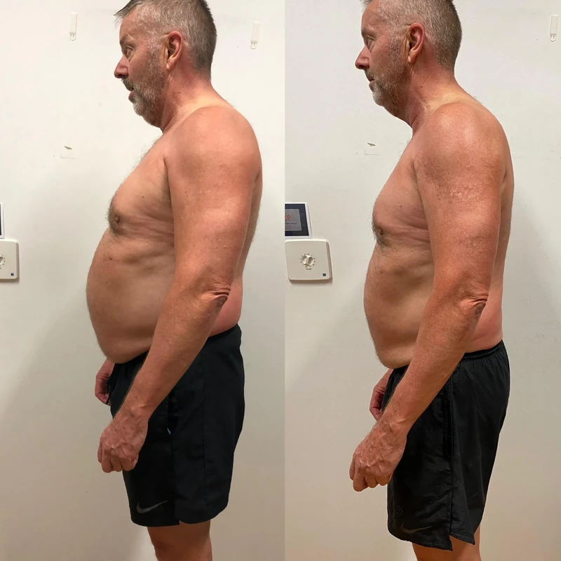 Peter transformation