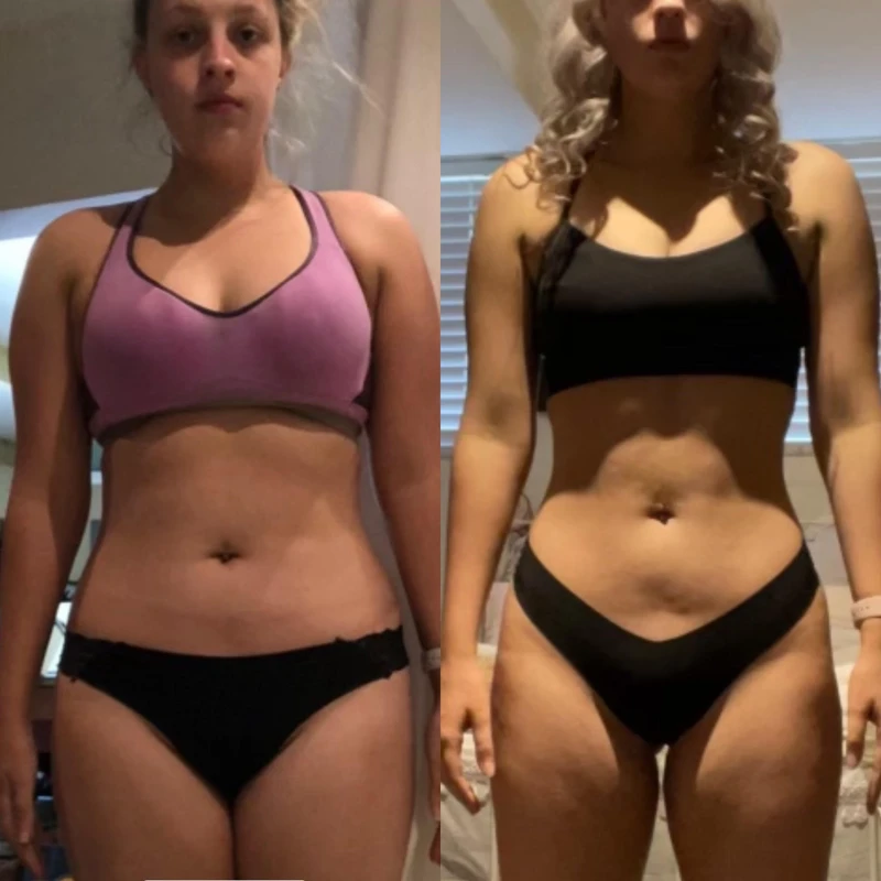 Chelsea transformation