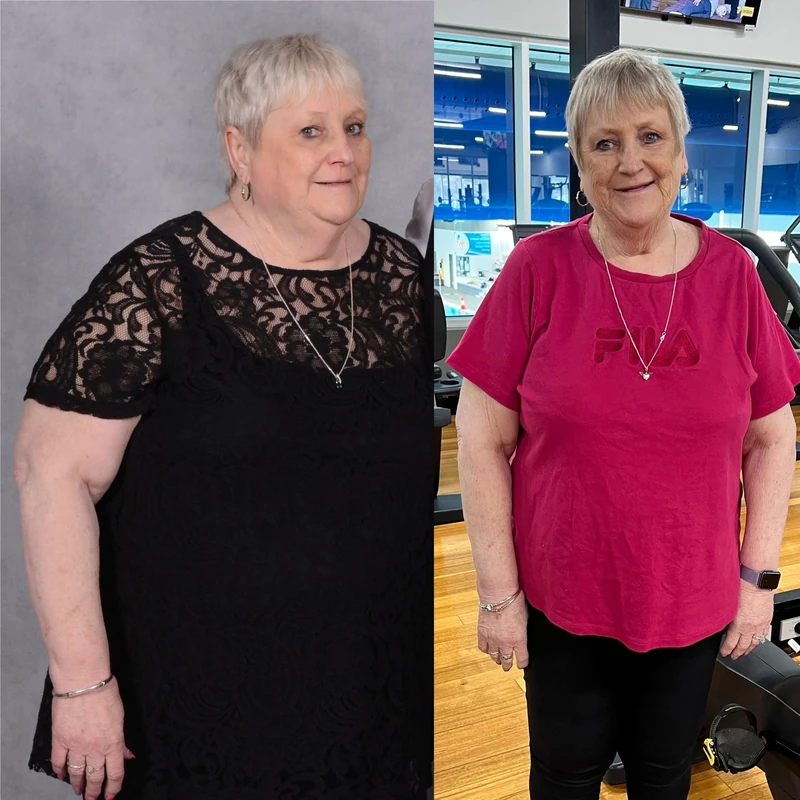 Susan transformation