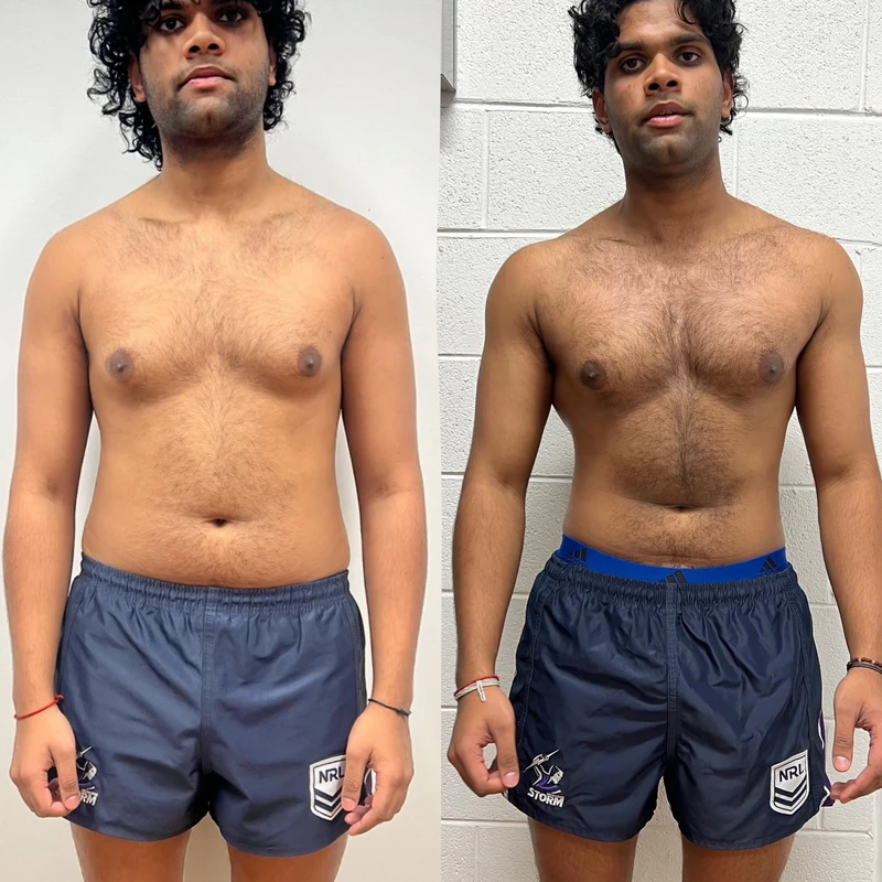 Hemish transformation