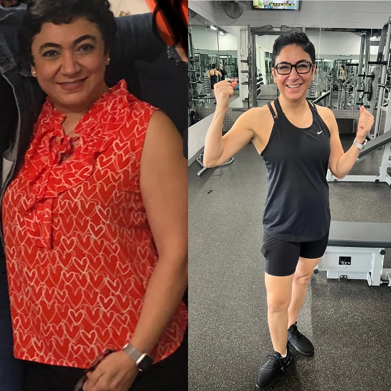 Zo transformation